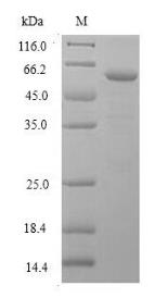 SDS-PAGE (DNASE1L3-12097H).jpg